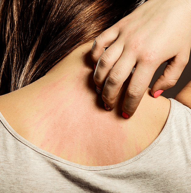 Protein Powder Cause Side Effects at Shawna Delaney blog